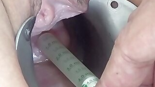 Insertion of Semen with Syringe into Uterus